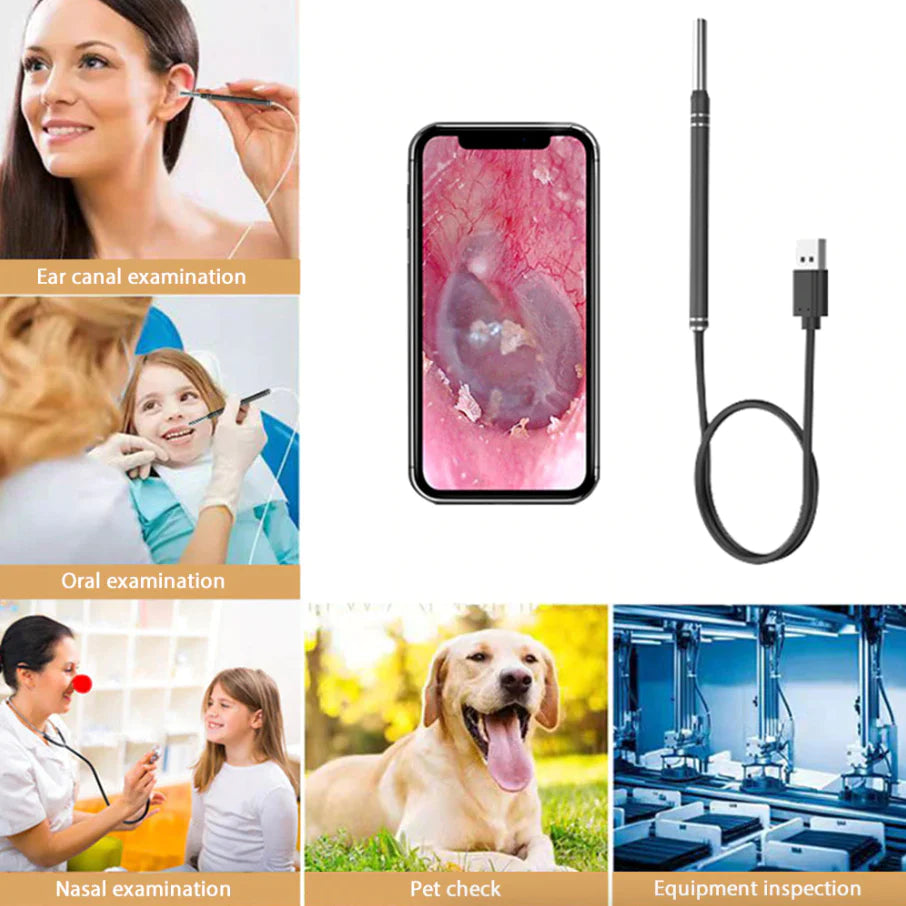 Viral HD LED Ear Endoscope Otoscope Camera Ear Wax Pick Cleaning Tool Cleaner Removal Kit